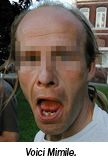 Image Image